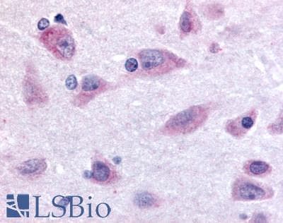 IHC-plus™ PROKR2/Prokineticin Receptor 2 Antibody (N-Terminus)