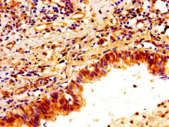 PTX3 / Pentraxin 3 Antibody