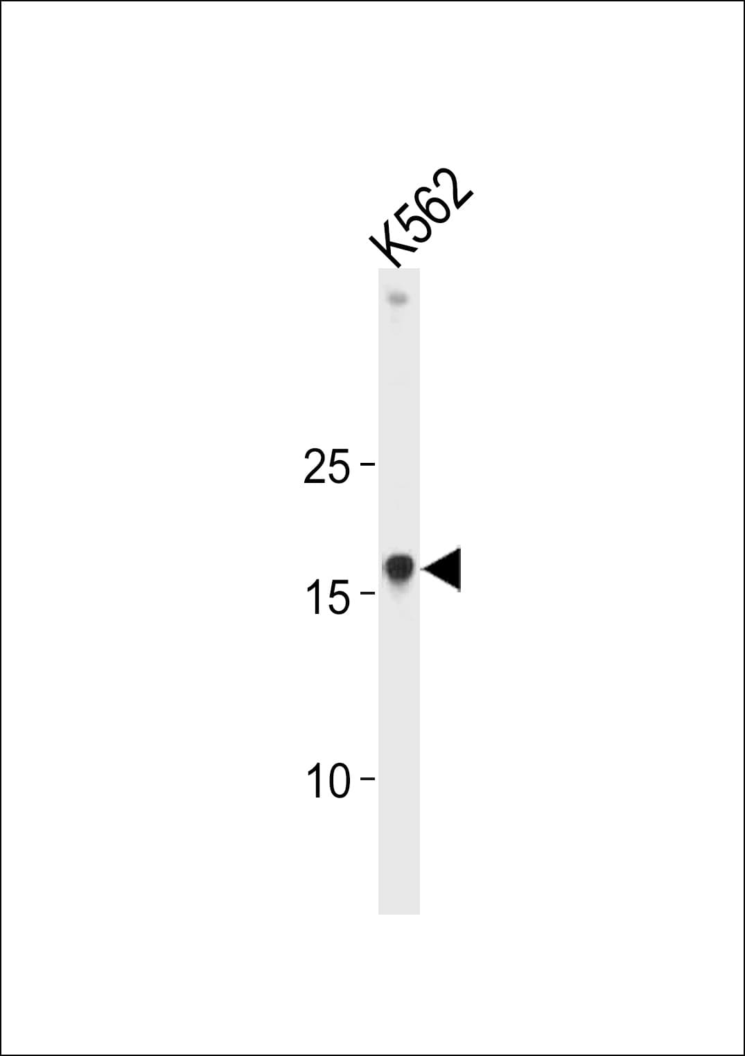 HMGIY / HMGA1 Antibody (aa64-93)
