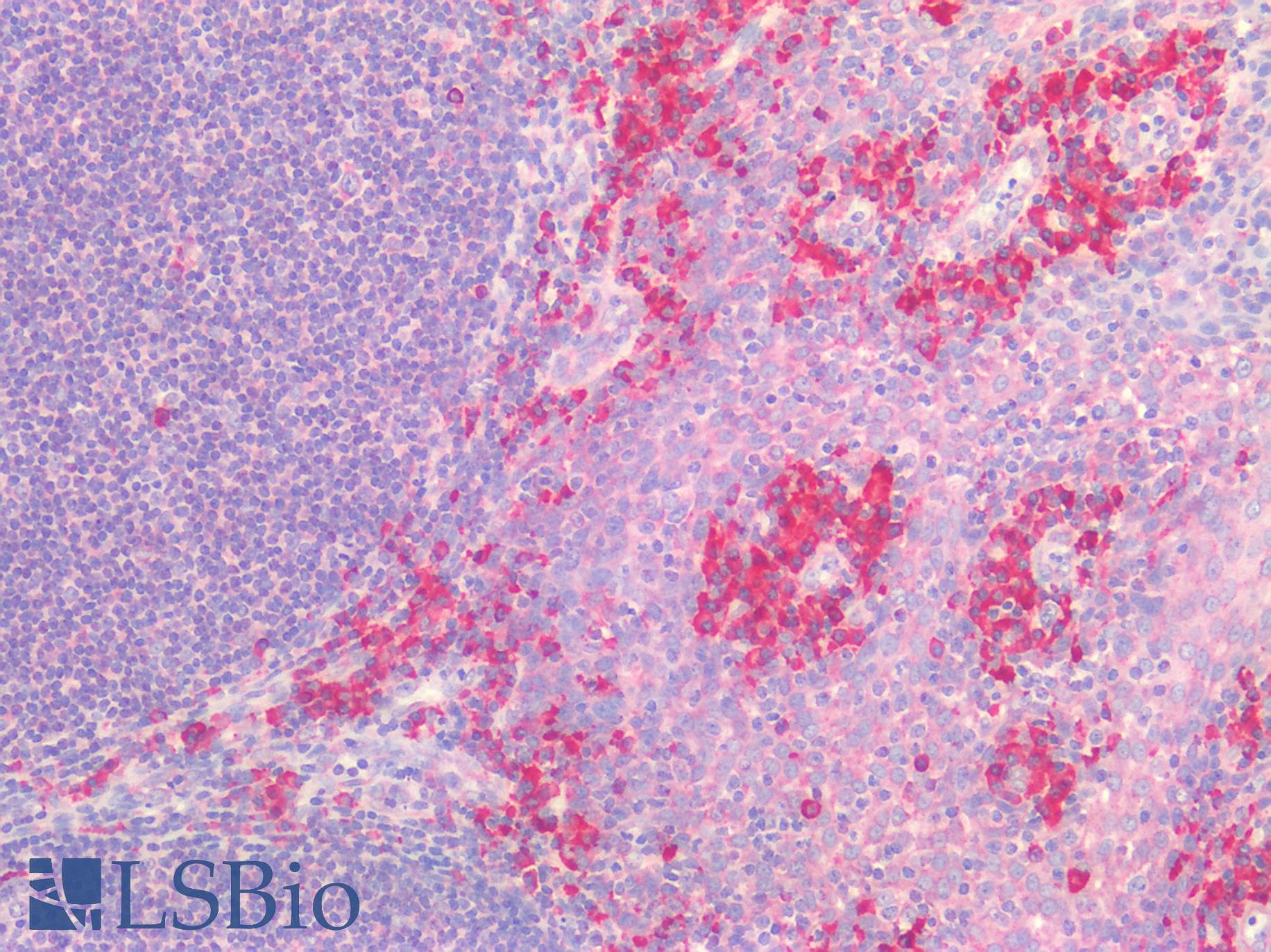 IHC-plus™ Polyclonal Rabbit anti-Human PDGFRA / PDGFR Alpha Antibody (IHC)