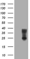 EMA / MUC1 Antibody (clone OTI1F3)