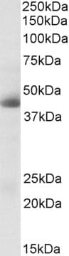 IHC-plus™ CA12 / Carbonic Anhydrase XII Antibody (aa188-199)