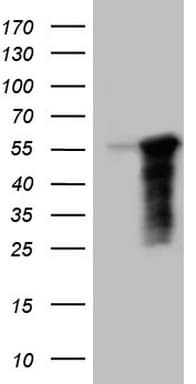LRRC6 Antibody (clone OTI1A1)