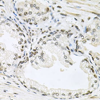 Polyclonal Rabbit anti-Human MAPK8 / JNK1 Antibody (IHC, IF, WB)