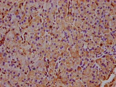Polyclonal Rabbit anti-Human INPP5E Antibody (IHC, IF)