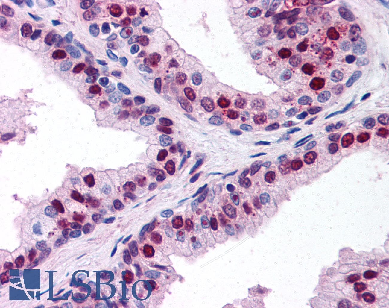 IHC-plus™ CITED2 Antibody (clone JA22)