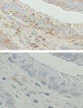HSD17B10 / HADH2 Antibody (aa199-235)