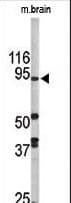 KDM1A / LSD1 Antibody (aa108-142)