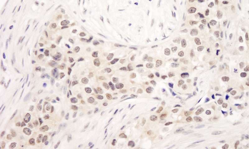 Polyclonal Rabbit anti-Human UIMC1 / RAP80 Antibody (aa650-C-term, IHC, WB)