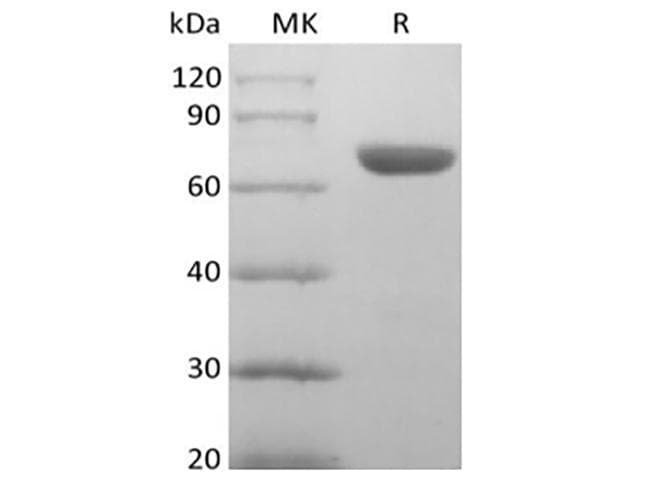 Human EPHA8 / EPH Receptor A8 Protein (Recombinant 6His, C-terminus)