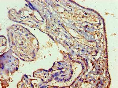 RAB5A / RAB5 Antibody (aa1-215)