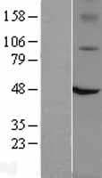 VR1 / TRPV1 Protein (Over-Expression Lysate Myc-DDK (Flag))