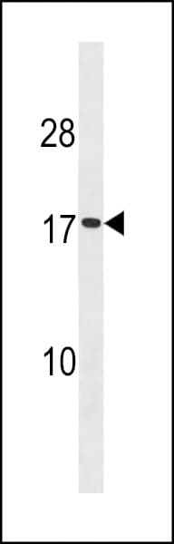 IHC-plus™ SPC18 / SEC11A Antibody (aa95-123)