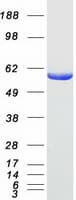 Human OXCT1 Protein (Recombinant Myc-DDK (Flag))