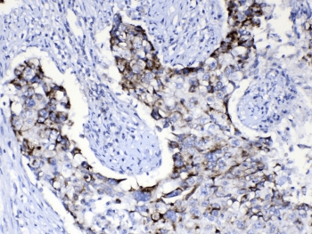 Polyclonal Rabbit anti-Human PIK3CB / PI3K Beta Antibody (IHC, WB)
