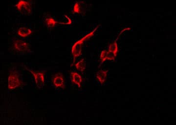 AATF Antibody