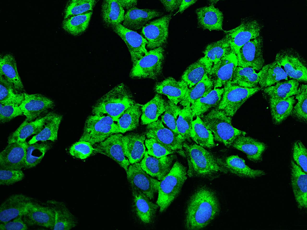 Polyclonal Rabbit anti-Human RPS5 / Ribosomal Protein S5 Antibody (IHC, IF, WB)