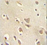Polyclonal Rabbit anti-Human MCHR1 Antibody (aa396-422, IHC, WB)