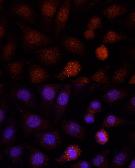 NSPC1 / PCGF1 Antibody