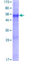 Human SLC39A11 / ZIP11 Protein (Recombinant GST)