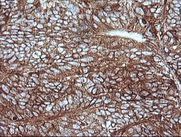 MAP2K1 / MKK1 / MEK1 Antibody (clone OTI2B2, Carrier-free)