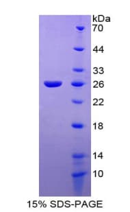 Human TIE1 / TIE Protein (Recombinant His-T7)