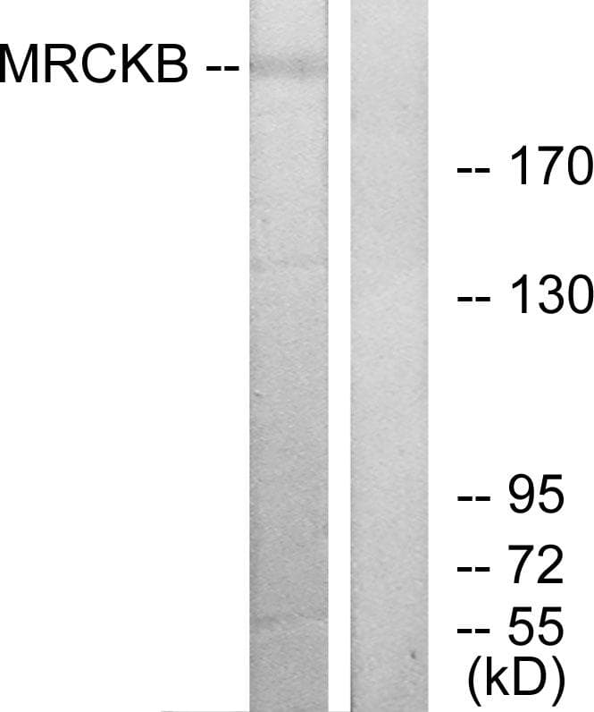 CDC42BPB / MRCKB Antibody