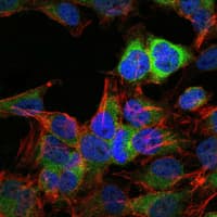 IHC-plus™ Monoclonal Mouse anti-Human HSP90AB1 / HSP90 Alpha B1 Antibody (clone 5G4, aa149-357, IHC, IF, WB)