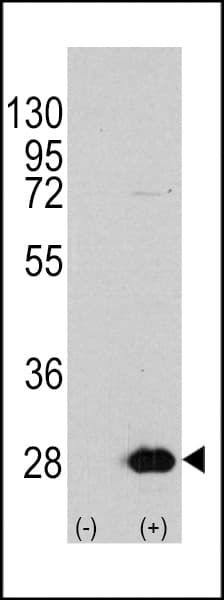 HSPB1 / HSP27 Antibody (Ser78)