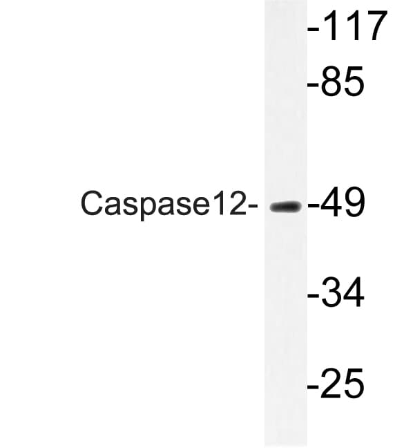 CASP12 / Caspase 12 Antibody (aa50-99)