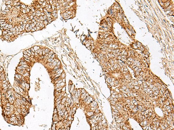 GNAT1 Antibody