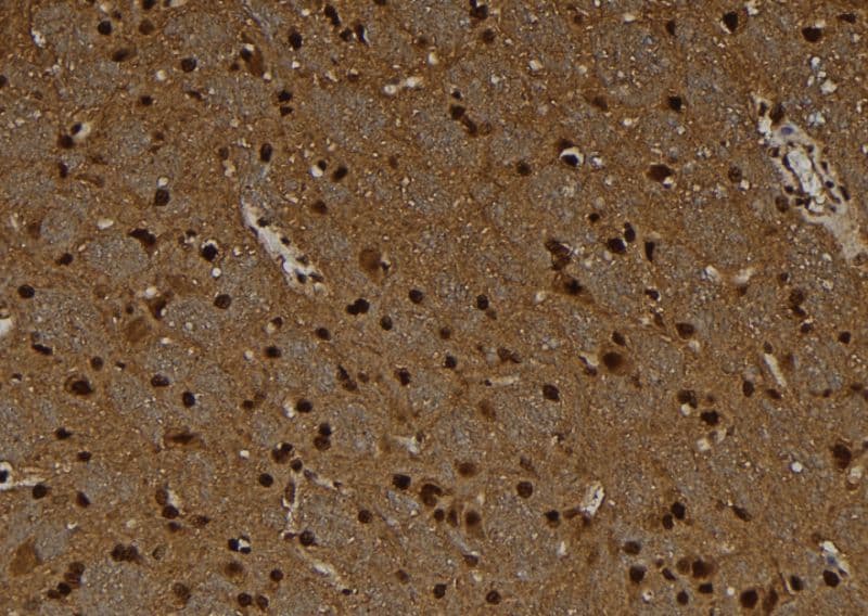 MAGEC1 Antibody