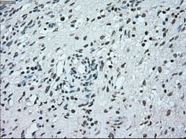 Monoclonal Mouse anti-Human BRAF / B-Raf Antibody (clone OTI1G6, IHC, WB)