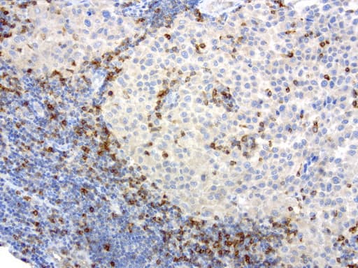 Monoclonal Mouse anti-Human PDCD1 / CD279 / PD-1 Antibody (clone UMAB198, Carrier-free, IHC, IF, WB)