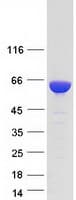 Human TKFC / DAK Protein (Recombinant Myc-DDK (Flag))