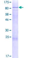 Human CDC73 / Parafibromin Protein (Recombinant GST)