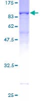Human RANGAP1 Protein (Recombinant GST)