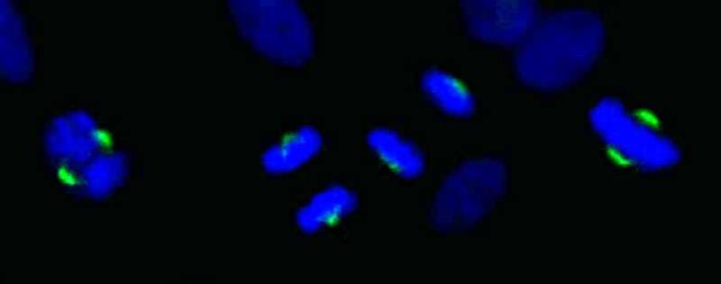 ASPM Antibody (aa3425-C-term)