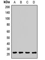 Polyclonal Rabbit anti-Human ARF5 Antibody (WB)