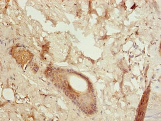 LGALS12 / Galectin 12 Antibody