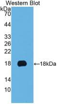 KRT19 / CK19 / Cytokeratin 19 Antibody (PE)