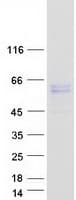 Human ALK2 / ACVR1 Protein (Recombinant Myc-DDK (Flag))