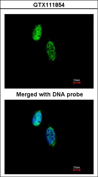 CKS2 Antibody (aa15-79)