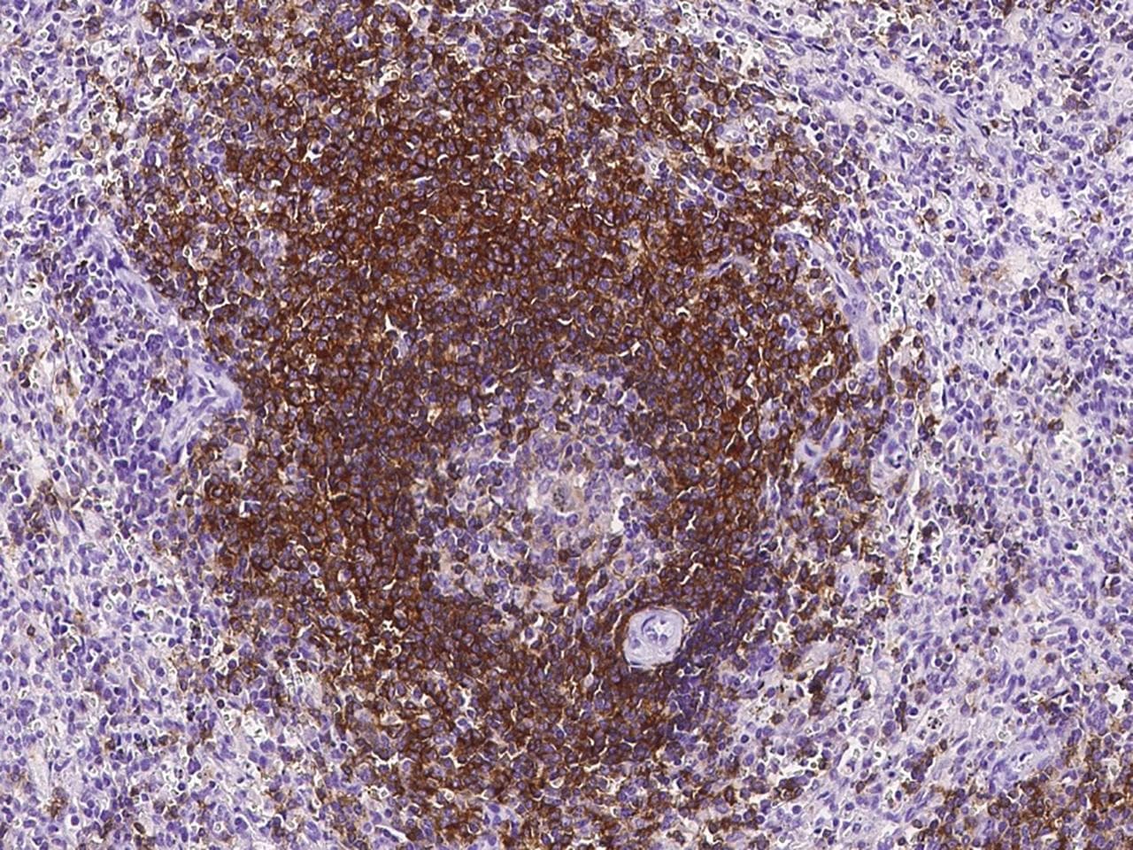BAFF Receptor / CD268 Antibody