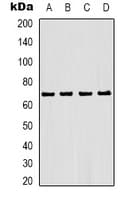 ER Alpha / Estrogen Receptor Antibody