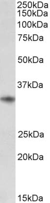 IHC-plus™ Polyclonal Goat anti-Human CD74 / CLIP Antibody (aa159-171, IHC, WB)