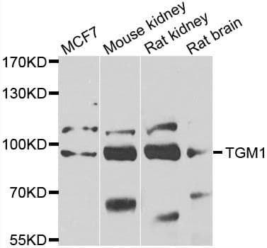 TGM1 / Transglutaminase Antibody