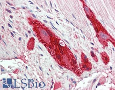 RLBP1 / CRALBP Antibody