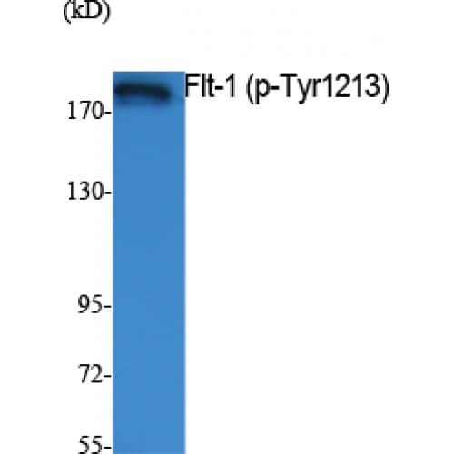 Polyclonal Rabbit anti-Human FLT1 / VEGFR1 Antibody (1150-1230 aa, WB)