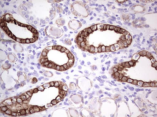 Peripherin Antibody (clone OTI3F4)